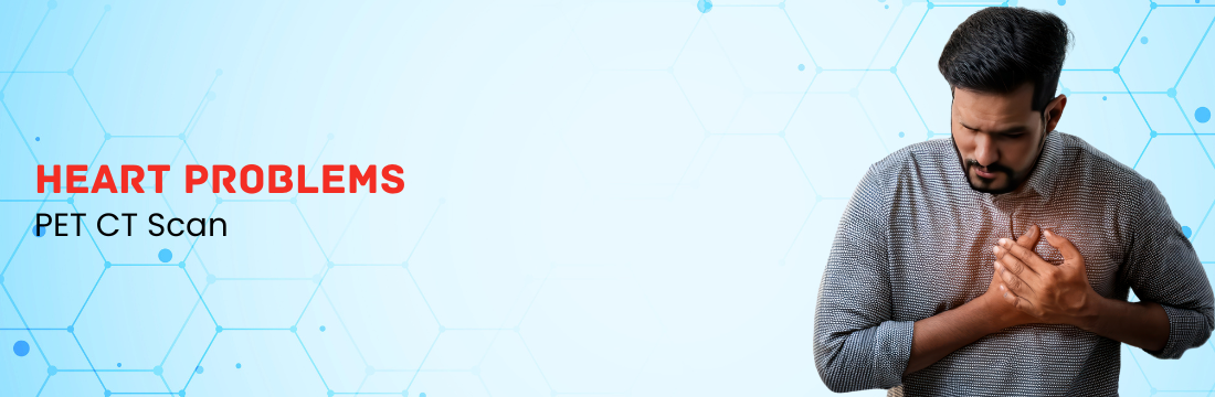 PET CT Scan for Heart Problems: A Complete Guide